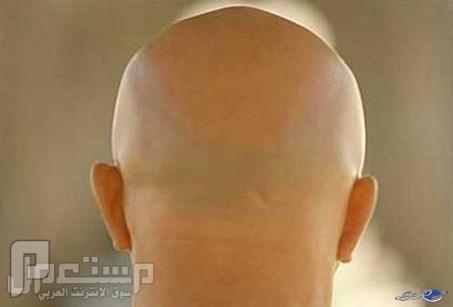 الرجال 'الصلع' أكثر تأثيراً وجدارة بالثقة