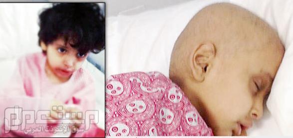 شاهد بالصور حقن طفلة علاج كيماوي بالخطأ في القصيم !