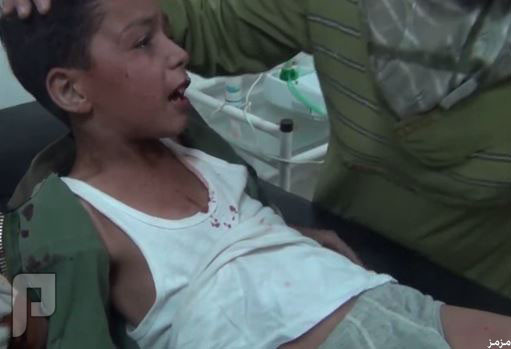 طفل سوري مصاب: ماما لا تخافي هذا دم بشار (فيديو)