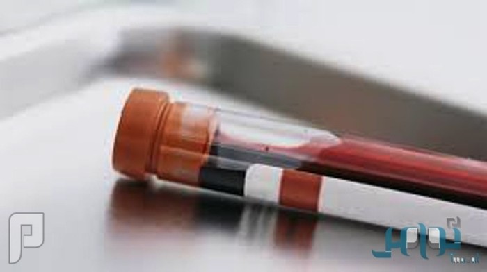 اختبار للدم يكشف الإصابة بالسرطان قبل حدوثها بـ”5″ سنوات