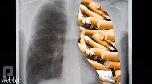ما هي السجائر الالكترونية واضرارها وهل هي بديل للتدخين ؟