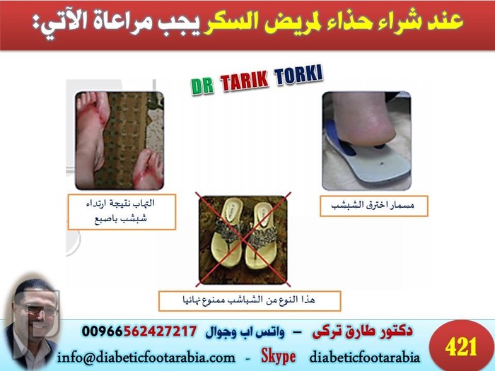 حذاء مريض السكرى المواصفات الضرورية و النصائح و التحذيرات | دكتور طارق تركى