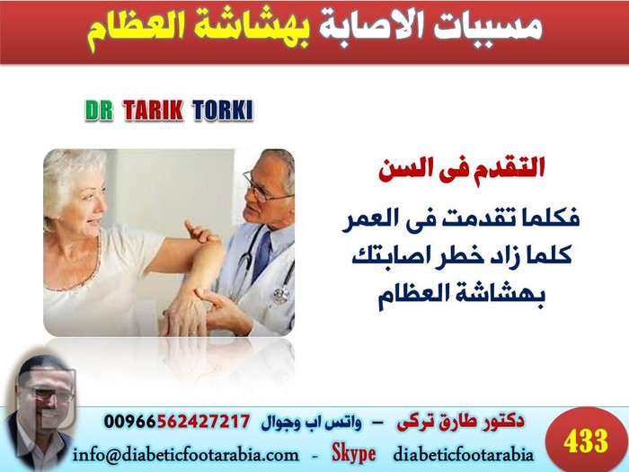 مسببات الاصابة بهشاشة العظام | دكتور طارق تركى