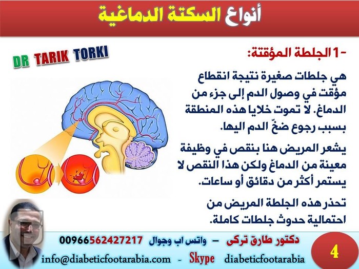السكتة الدماغية أسباب علاج و طرق وقائية | دكتور طارق تركى انواع السكتة الدماغية | دكتور طارق تركى