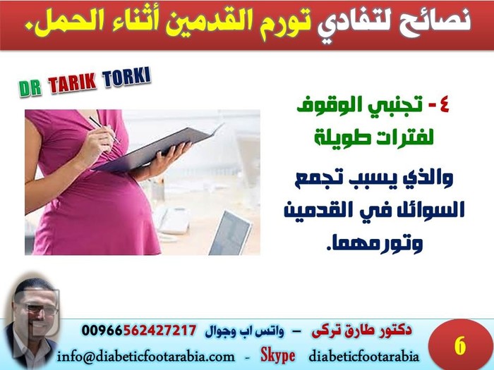 نصائح لتفادي تورم القدمين أثناء الحمل | دكتور طارق تركى
