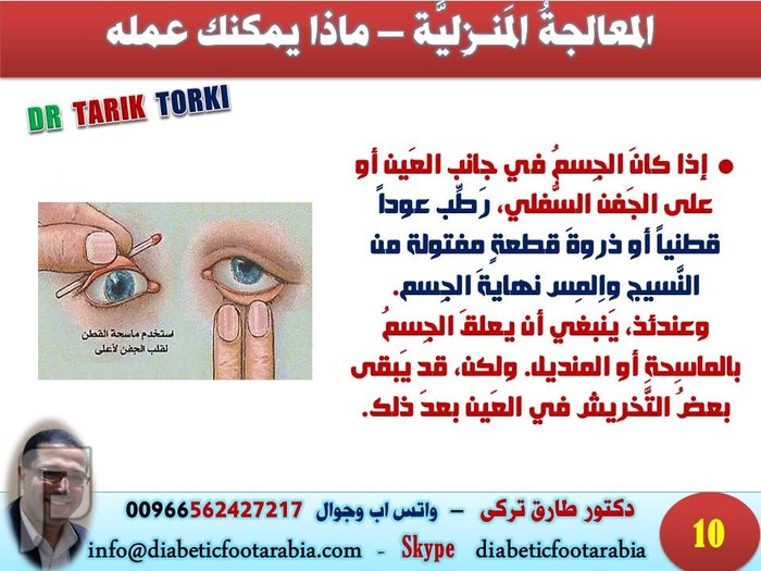 الإسعافات الأولية - دخول جسم في العين | دكتور طارق تركى
