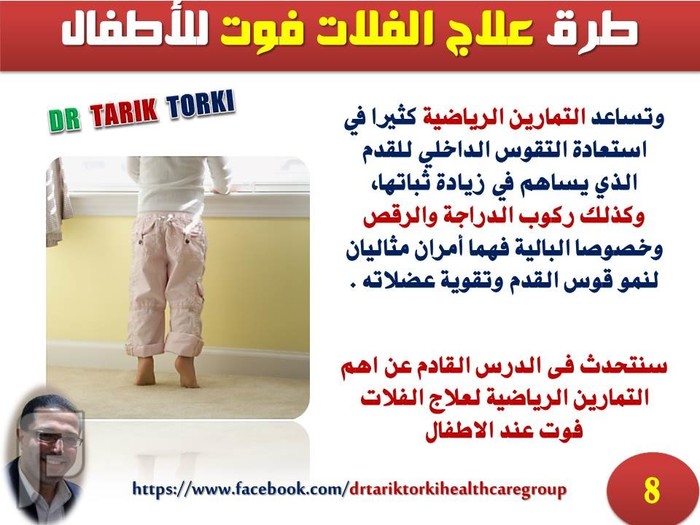طرق علاج الفلات فوت للأطفال | دكتور طارق تركى