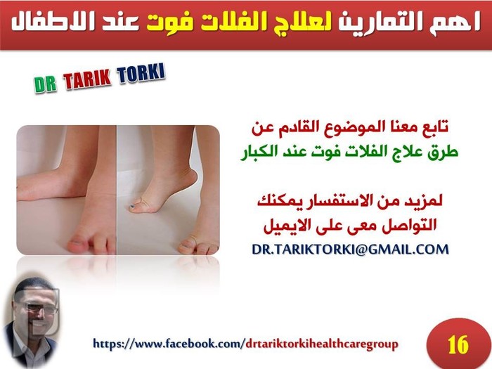 اهم التمارين لعلاج الفلات فوت عند الاطفال | دكتور طارق تركى