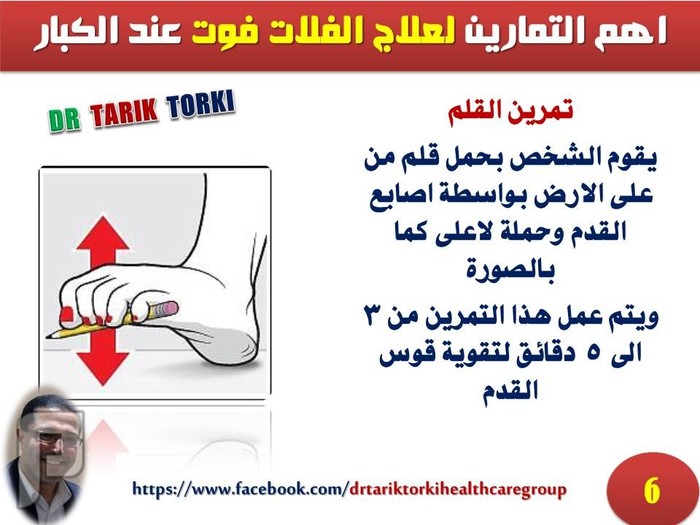 اهم التمارين لعلاج الفلات فوت عند الكبار | دكتور طارق تركى