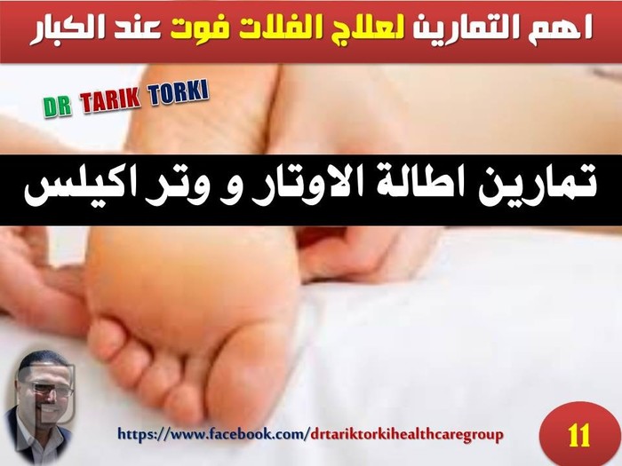 اهم التمارين لعلاج الفلات فوت عند الكبار | دكتور طارق تركى