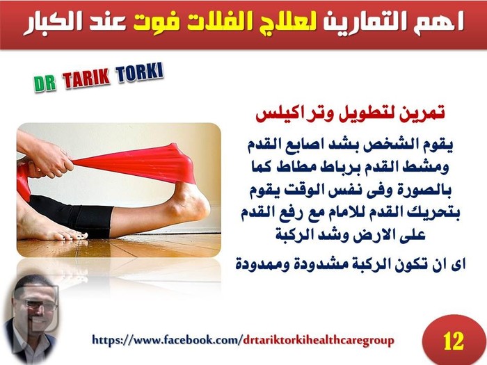 اهم التمارين لعلاج الفلات فوت عند الكبار | دكتور طارق تركى