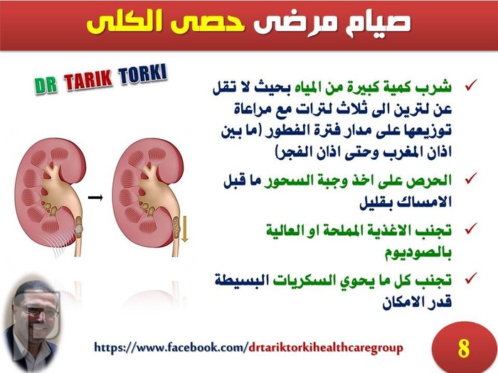 أمراض الكلى والصيام في رمضان! | دكتور طارق تركى