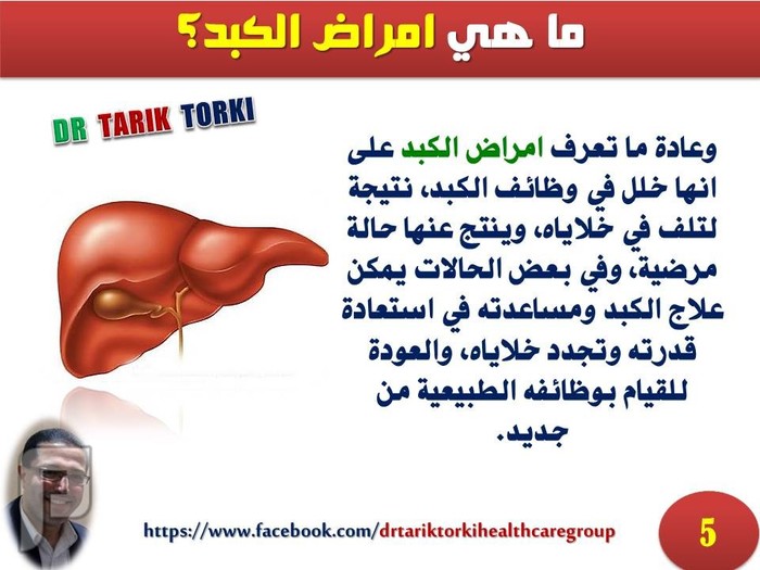 مريض الكبد والصيام فى رمضان | دكتور طارق تركى
