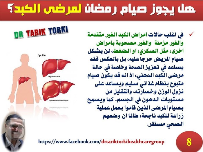 مريض الكبد والصيام فى رمضان | دكتور طارق تركى
