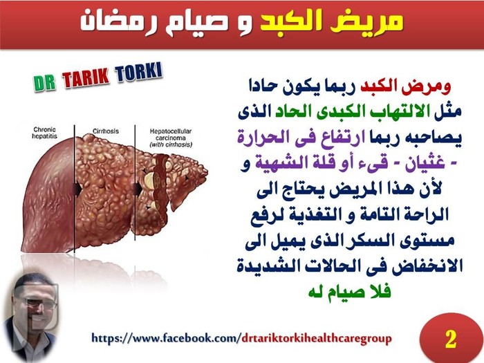 مريض الكبد و صيام رمضان | دكتور طارق تركى