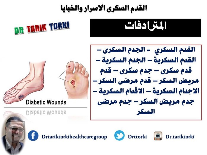 القدم السكرى اسرار وخبايا | تعريف القدم السكرى | دكتور طارق تركى