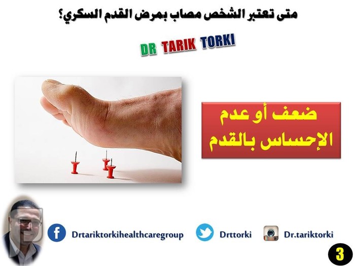 متى تعتبر الشخص مصاب بمرض القدم السكري؟ | دكتور طارق تركى