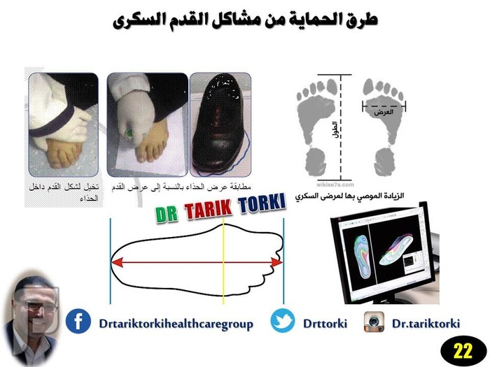طرق الحماية من مشاكل القدم السكرى | دكتور طارق تركى
