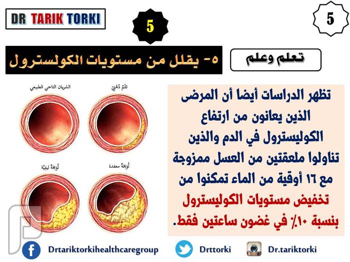 5 فوائد للماء المحلى بالعسل لا تعرفها | دكتور طارق تركى