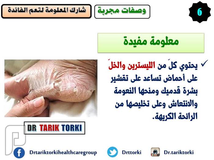 وصفة اللسترين والخل والماء لعلاج جفاف القدمين بفاعلية | دكتور طارق تركى
