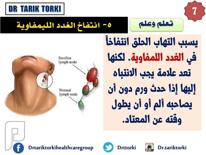 5 علامات تدل على الاصابة بالسرطان | دكتور طارق تركى