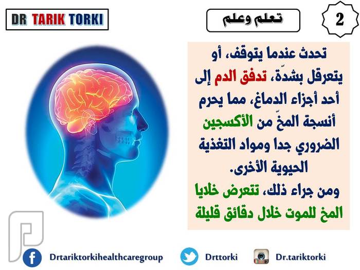 5 أعراض مفاجئة للسكتة الدماغية | دكتور طارق تركى