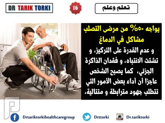 حقائق غريبة عن مرض التصلب اللويحى او التصلب المتعدد | دكتور طارق تركى