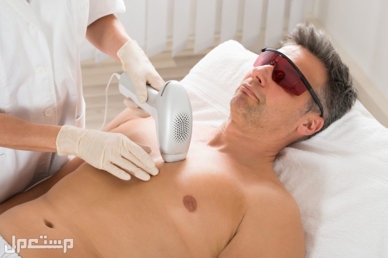 اختر الأنسب.. أفضل جهاز ليزر لإزالة الشعر جهاز ليزر