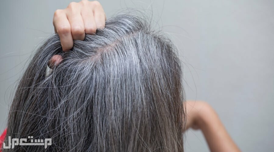 أسباب الشعر الأبيض عند الشباب وطرق العلاج