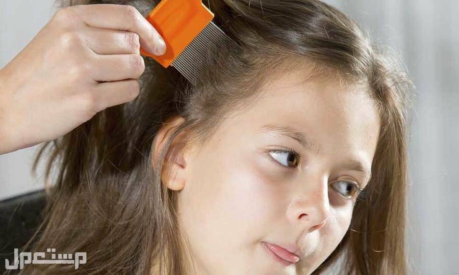 أسعار أفضل نوع شامبو للقمل في الإمارات العربية المتحدة القمل في شعر الأطفال