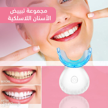 مجموعة تبييض الأسنان اللاسلكية متوفرة للطلب بكل المدن والتوصيل والشحن مجانا