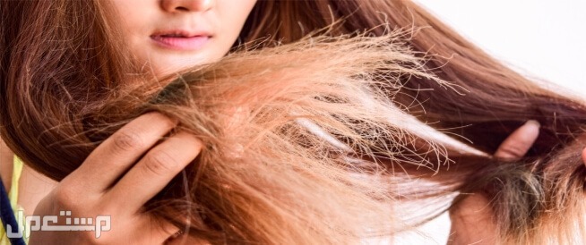 أفضل ماسك ترطيب الشعر ومواصفات وأسعار كاملة شعر مجهد