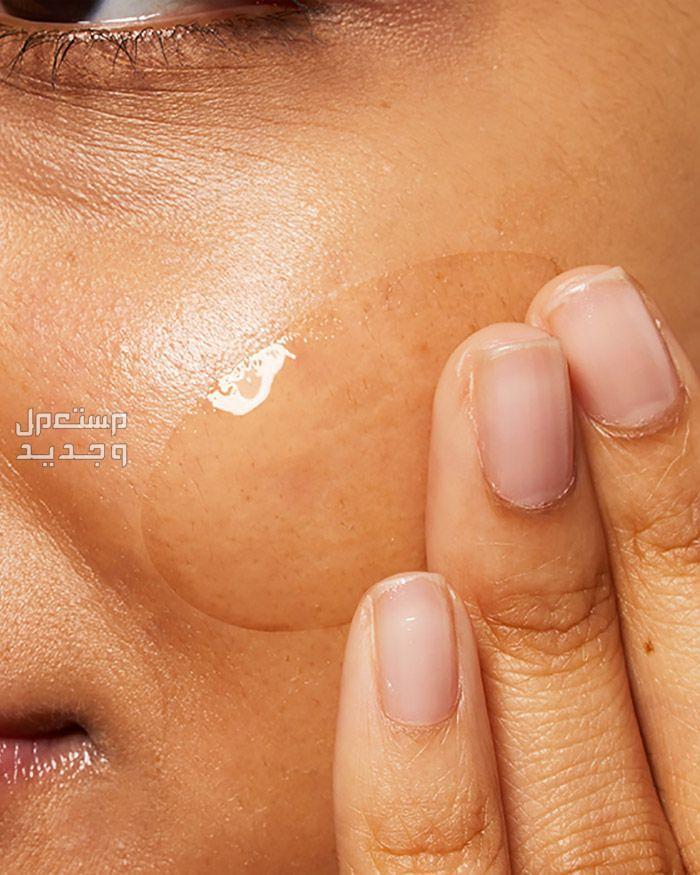 أفضل كريم لعلاج حب الشباب قوام كريم سيرافي acne control gel
