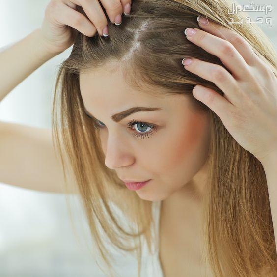 أسباب تساقط الشعر عند النساء وعلاجه تساقط الشعر