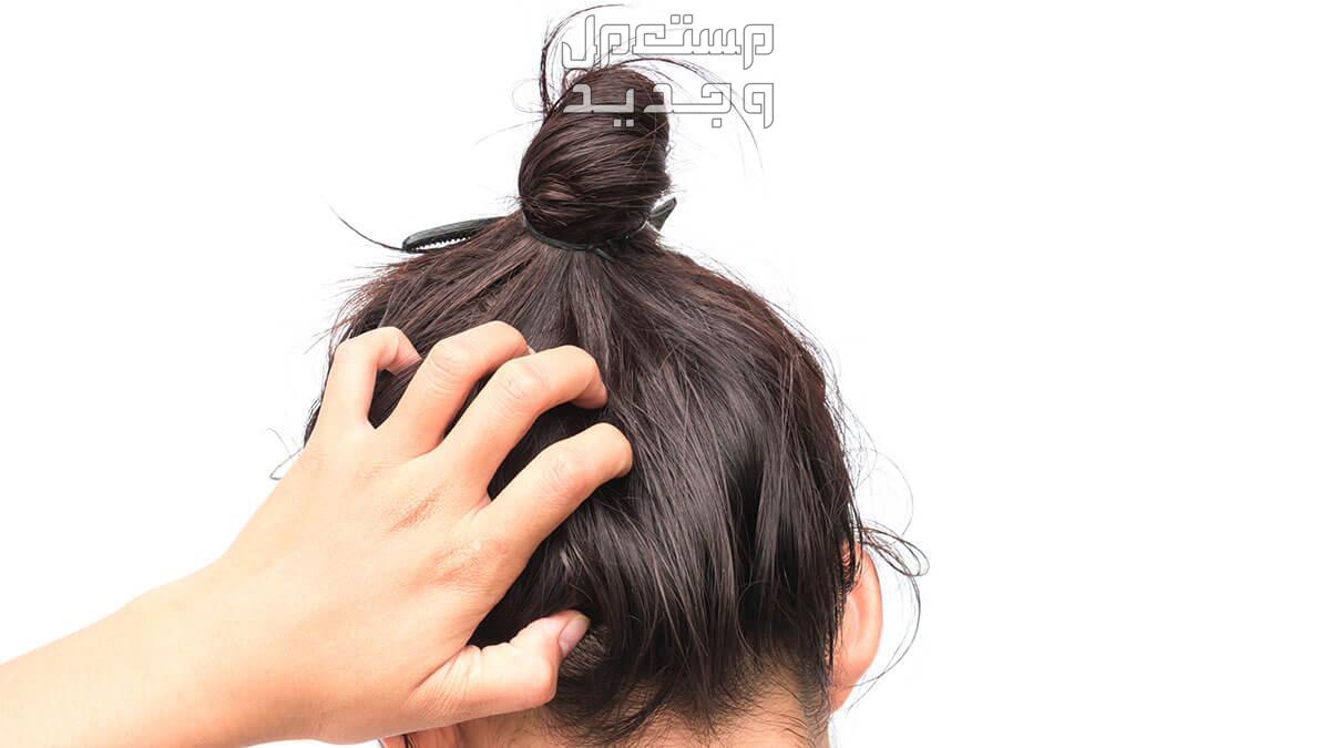 طريقة استخدام زيت الأرغان لتطويل الشعر في البحرين طريقة استخدام زيت الأرغان لتطويل الشعر لعلاج الحكة