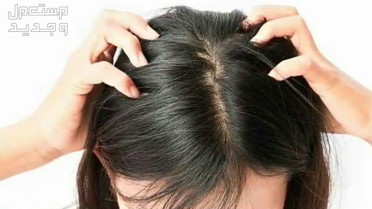 ما هو الفرق بين تساقط الشعر الطبيعي والغير طبيعي؟ في السودان كيف أعرف تساقط الشعر الطبيعي