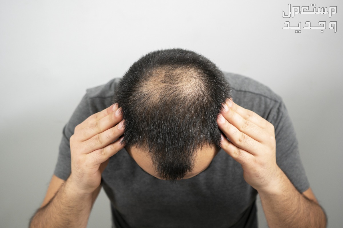ما هو الفرق بين تساقط الشعر الطبيعي والغير طبيعي؟ في العراق الفرق بين تساقط الشعر الطبيعي والغير طبيعي