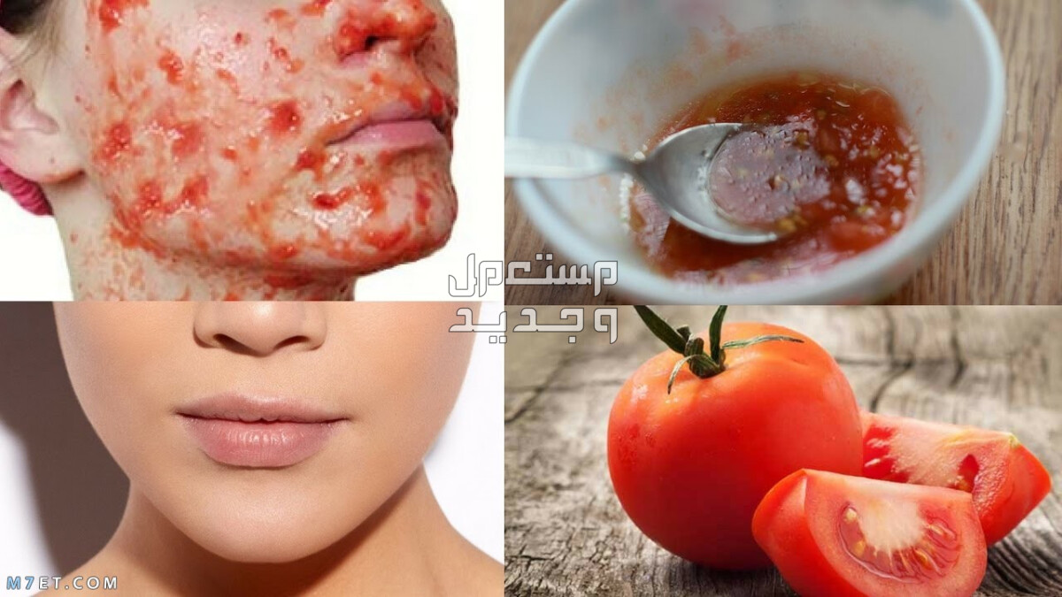 ماسك لإزالة الرؤوس السوداء للبشرة الدهنية إزالة الرؤوس السوداء من الوجه في 10 دقائق فقط