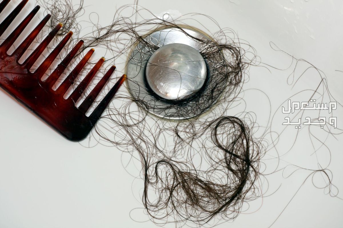 خلطات طبيعية للشعر المتساقط في عمان تساقط الشعر المزمن