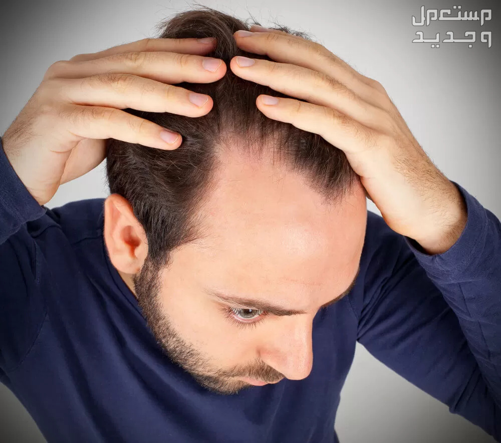 تفسير تساقط الشعر في المنام للرجل والعزباء والمتزوجة تفسير حلم سقوط الشعر للرجل