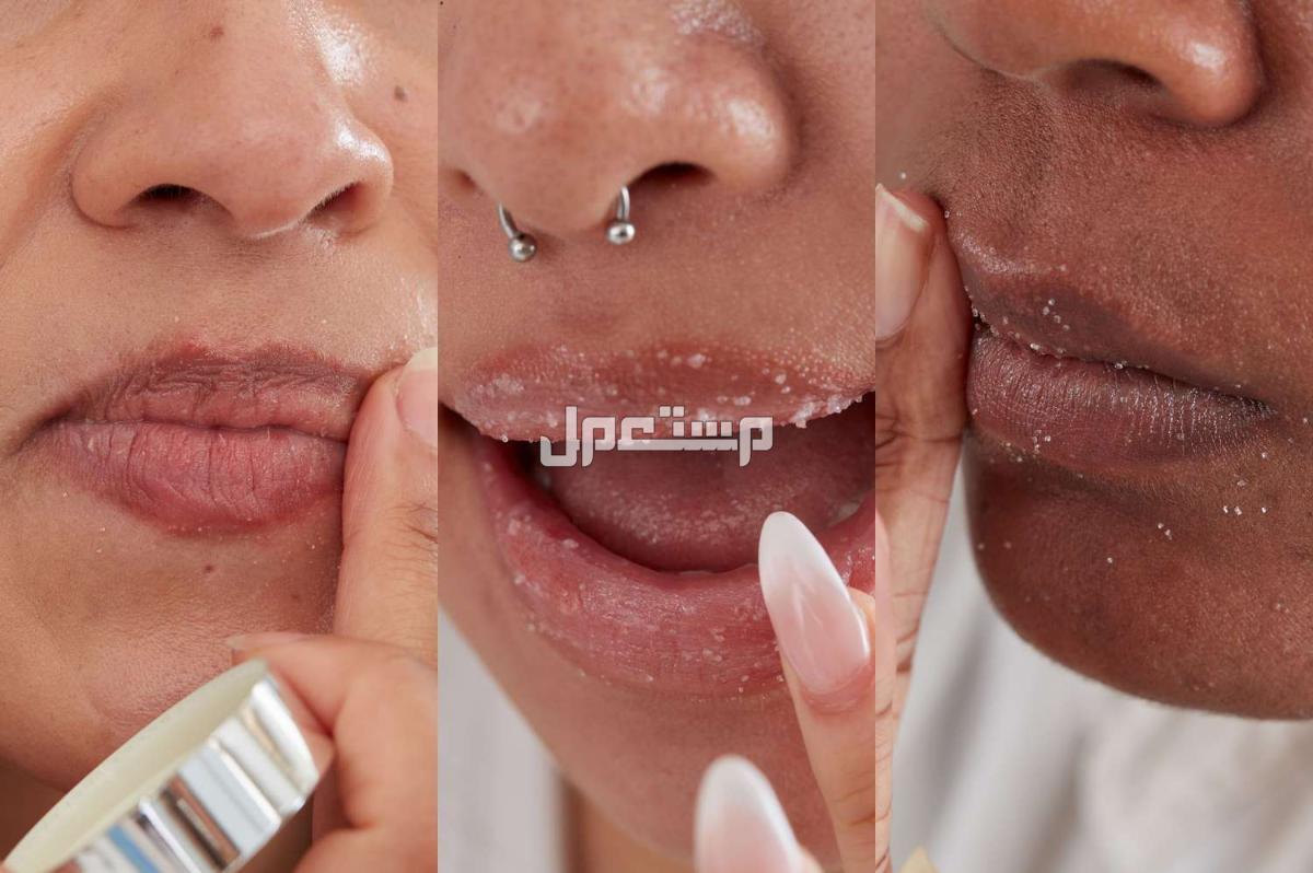 أسباب البقع الصبغية على الشفاه.. وطرق التخلص منها وصفة جوز الهند