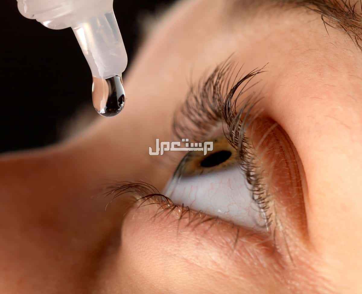 أفضل قطرة لعلاج جفاف العين لعام 2024 سيدة تضع قطرة في عينها