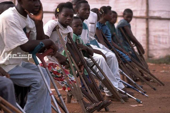 5 حقائق عن شلل الأطفال وطرق انتقاله وعلاجه اطفال مصابون بشلل الاطفال