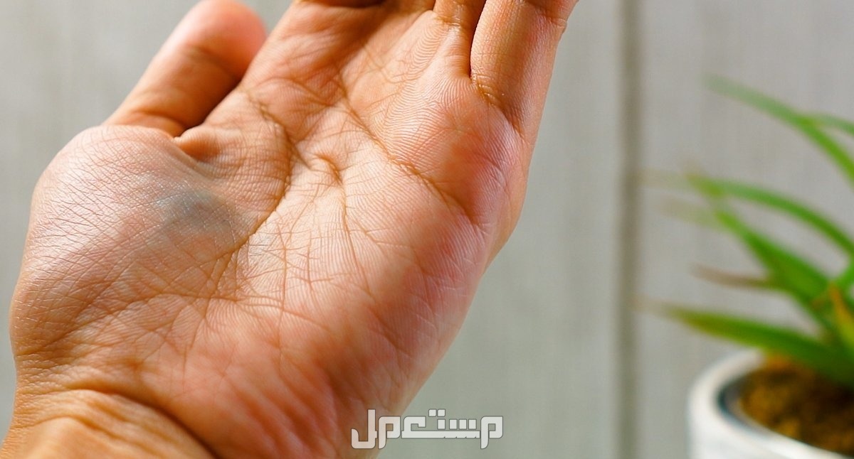 أفضل طرق تنظيف اليدين من الصبغة.. 6 وصفات سهلة من المنزل طرق تنظيف اليدين من الصبغة