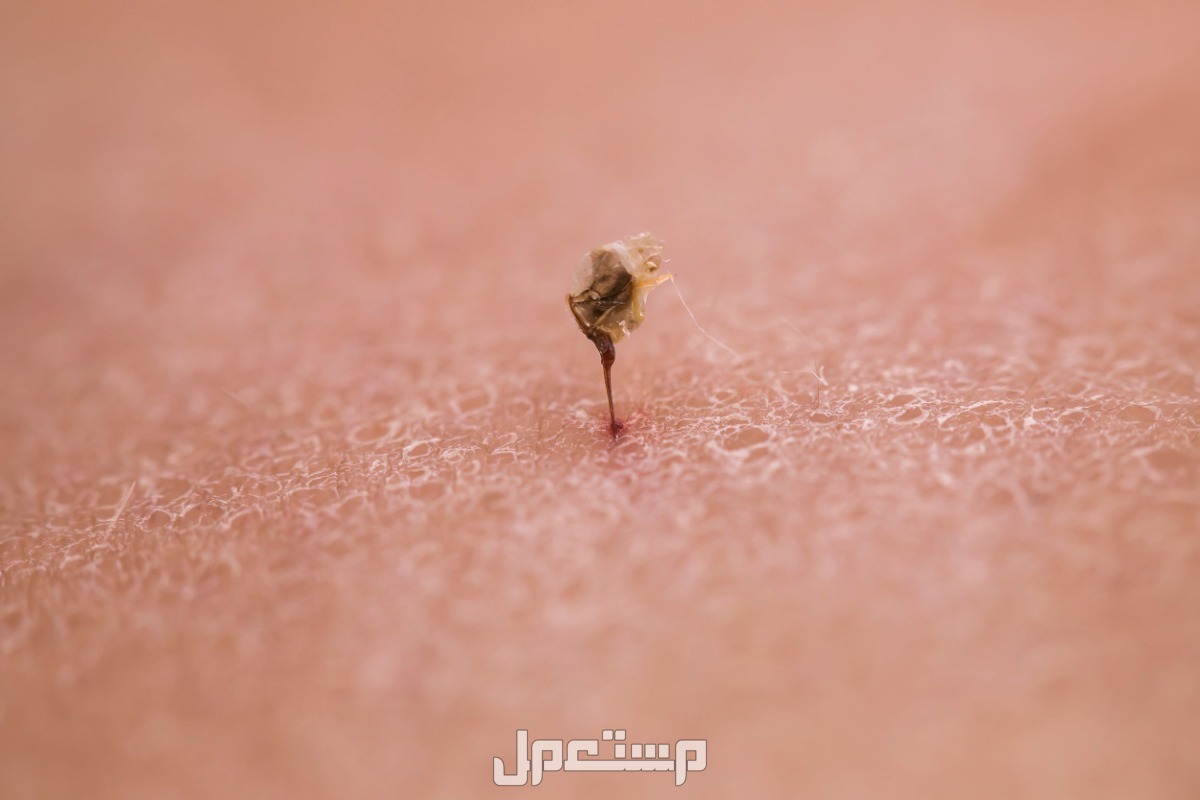 كل ما تريد معرفته عن سم النحل .. الفوائد والآثار الجانبية صورة تحت الميكروسكوب لسم النحل