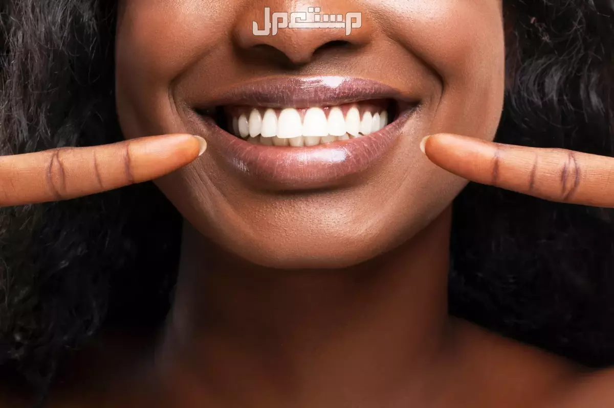أفضل 10 خلطات طبيعية لتبييض الأسنان بالصور طريقة تبييض الأسنان بالنشا