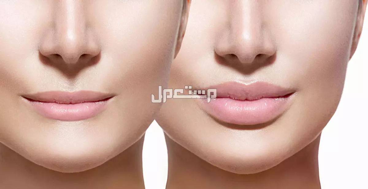 فوائد واضرار كريم ماكس فيلر وطريقة استخدامه سعر كريم ماكس فيلر