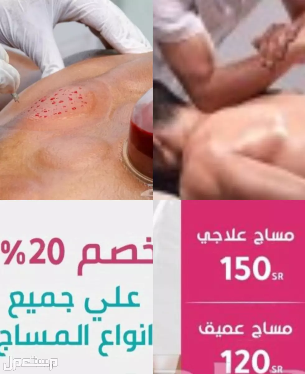 حجامه علاجيه و مساج تدليك منزلي مساج الظهر و حجامه الظهر