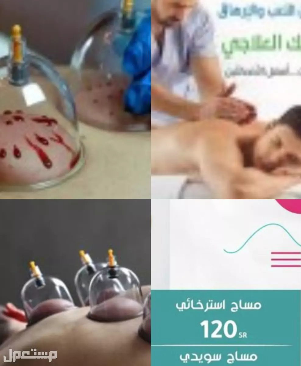حجامه علاجيه و مساج تدليك منزلي تدليك استرخائي و حجامه استرخائيه