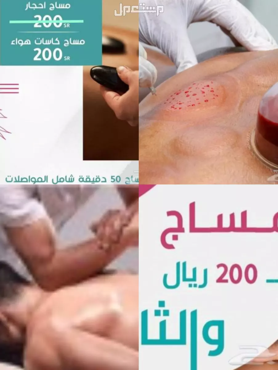 حجامه علاجيه و مساج تدليك منزلي مساج تدليك منزلي علاجي و حجامه علاجيه منزليه